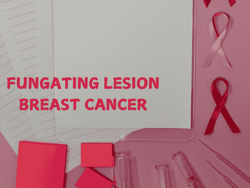 fungating lesion breast cancer